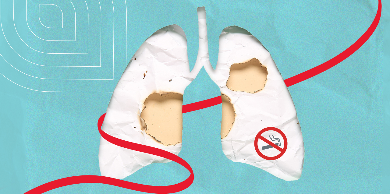 lung cancer